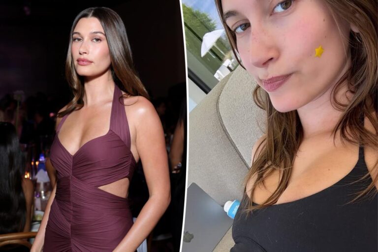 Hailey Bieber dealing with recurring health issue that previously left her ‘nauseous’